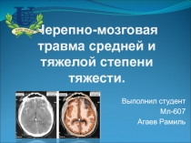 Черепно-мозговая травма средней и тяжелой степени тяжести