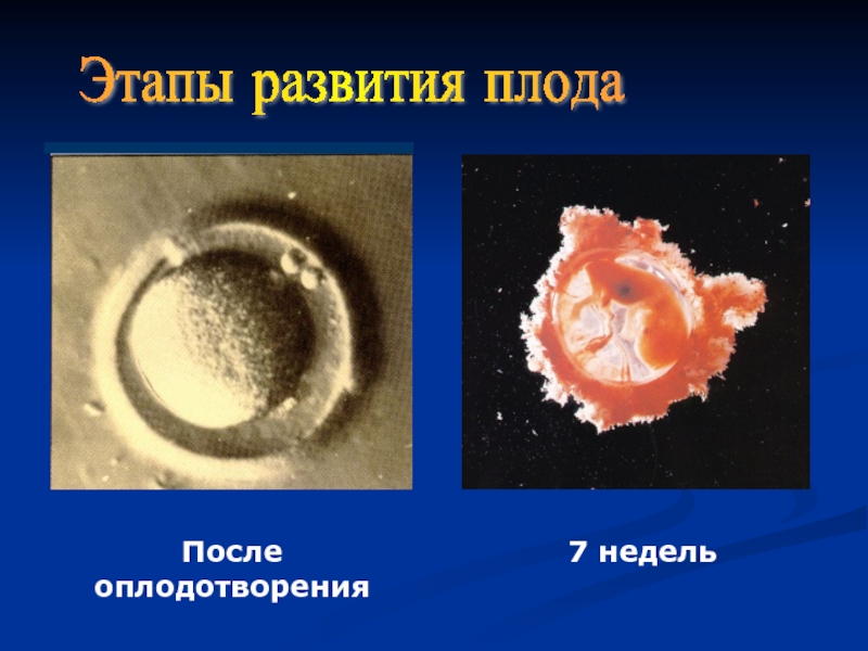 Развитие зародыша после оплодотворения. Стадии развития эмбриона. Этапы развития плода. Стадии развития эмбриона после оплодотворения. Эмбрион после оплодотворения.