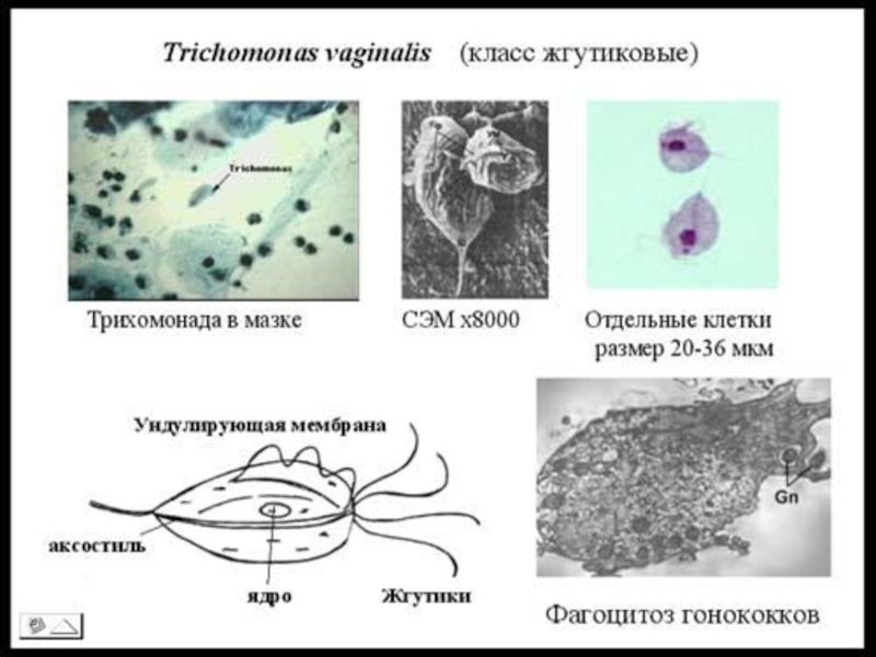 Трихомониаз диагностика