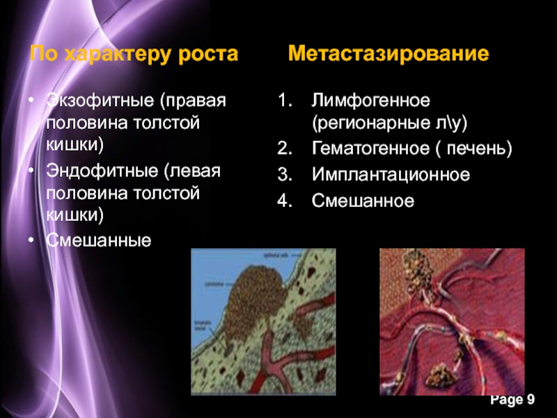 Классификация РШМ по типу роста экзофитным и эндофитным.