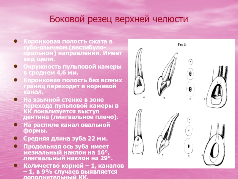 Боковой резец верхней челюсти фото