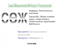 СӨЖ
Кафедра : Патологиялы қ анатомия
Тақырыбы : Жүрек ишемия ауруы,