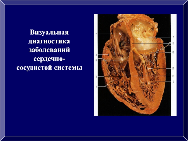 Визуальная диагностика заболеваний сердечно-сосудистой системы