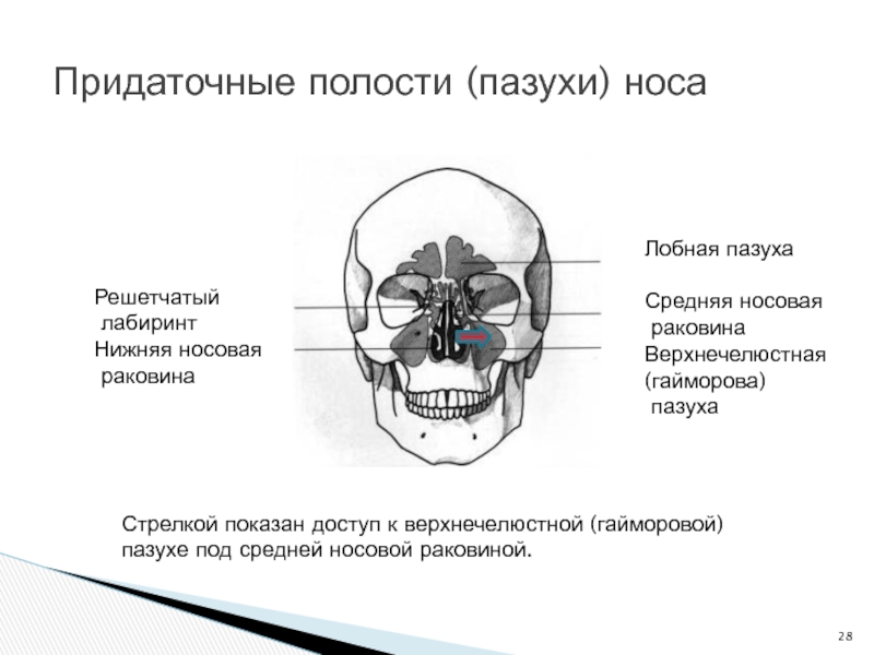 Анатомия верхнечелюстной пазухи презентация