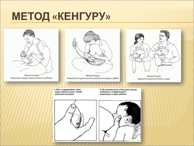 Метод кенгуру презентация