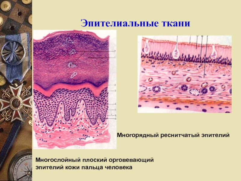 Пример эпителиальной ткани человека. Эпителиальная ткань кожный эпителий. Многослойный плоский эпителий ткани. Многослойный плоский эпителий кожи пальца человека. Многослойный ороговевающий эпителий пальца.