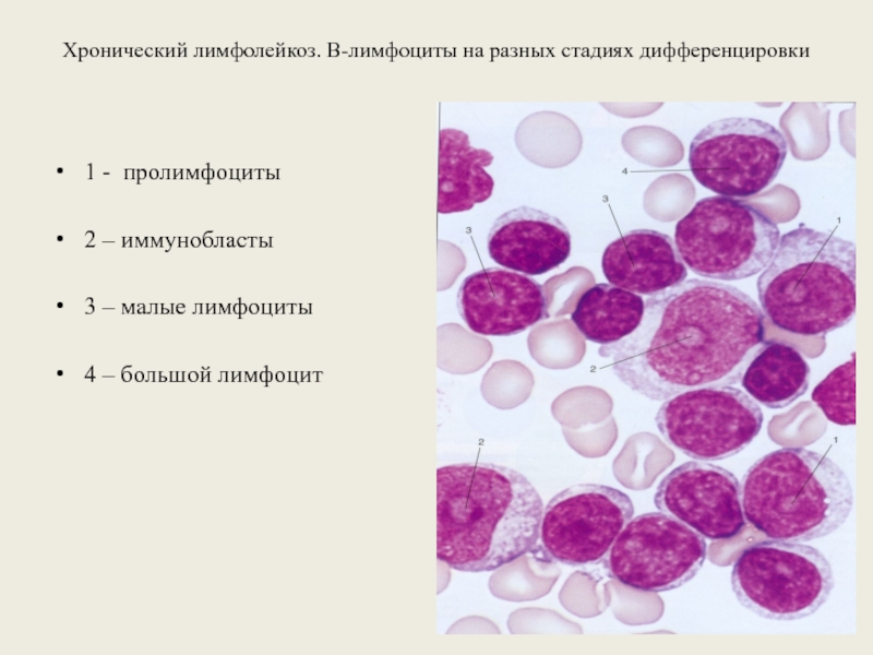 Реактивные лимфоциты в крови