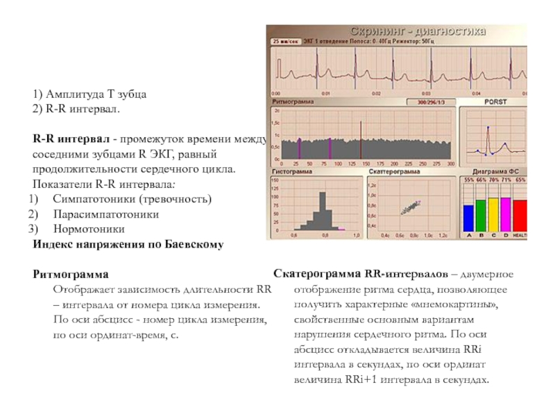 Длительность р. Интервал r r в ЭКГ. Продолжительность интервала r-r. Длительность сердечного цикла по ЭКГ. Скатерограмма сердечного ритма.