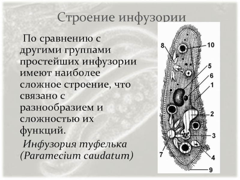 Виды инфузорий. Строение инфузории. Сосущая инфузория строение. Группа инфузории. Представители сосущих инфузорий.