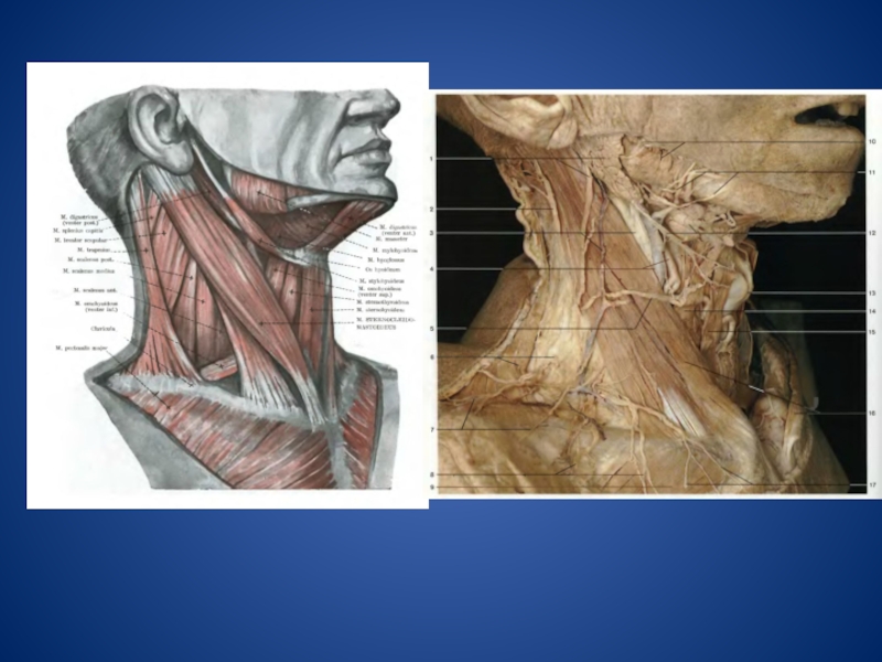 Мышцы шеи анатомия. Мышцы шеи анатомия Синельников. Мышцы шеи сбоку анатомия. Топография мышц головы и шеи. Топографическая анатомия головы атлас.