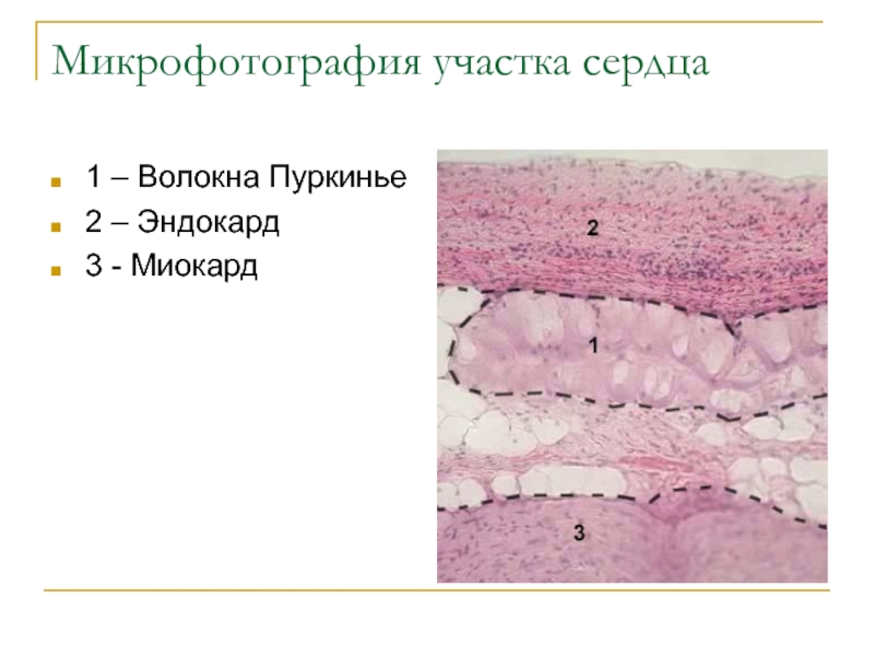 Эндокард рисунок гистология