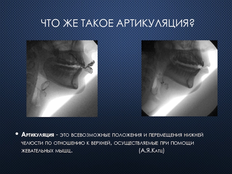 Методы исследования артикуляции презентация