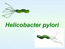 Helicobacter pylori