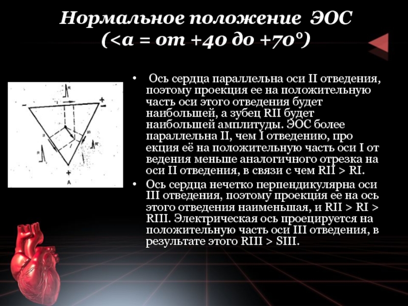 Горизонтальное положение электрической оси сердца