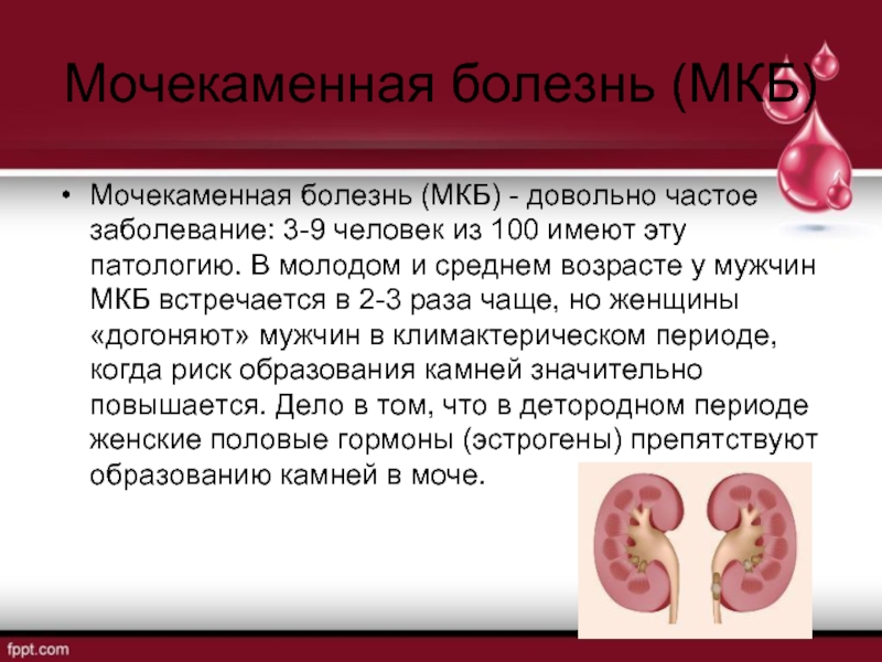 Мочекаменная болезнь (МКБ)Мочекаменная болезнь (МКБ) - довольно частое заболевание: 3-9 человек из 100 имеют эту патологию. В