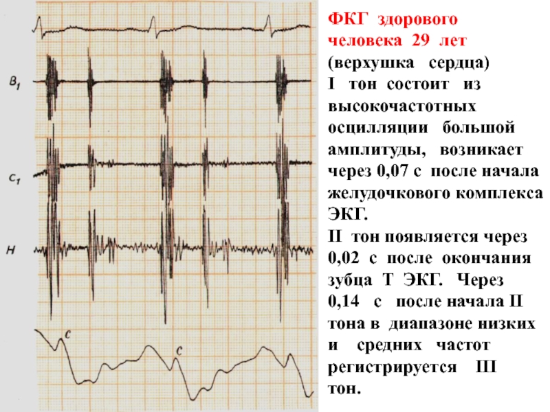 Поворот сердца