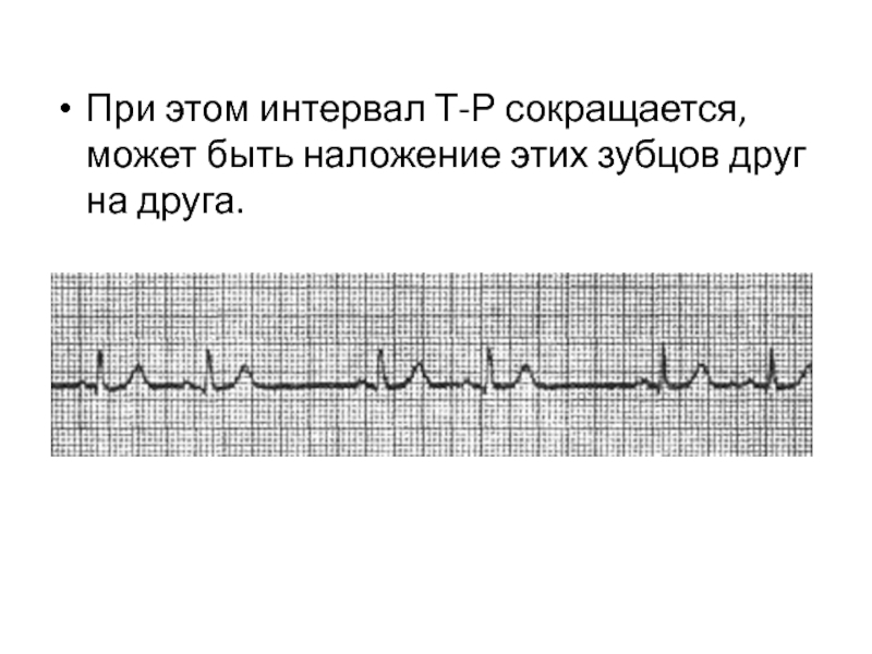 T интервал