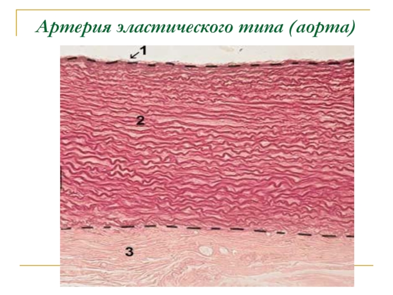 Артерия эластического типа рисунок