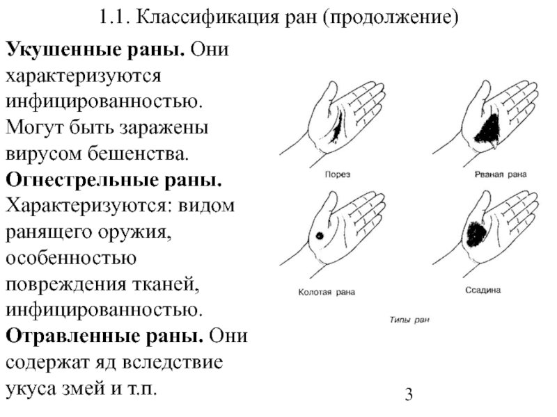 Виды ран и их характеристика презентация