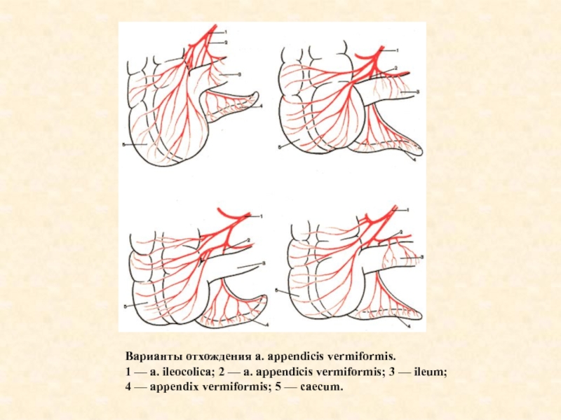 Варианты отхождения a. appendicis vermiformis.1 — a. ileocolica; 2 — a. appendicis vermiformis; 3 — ileum; 4