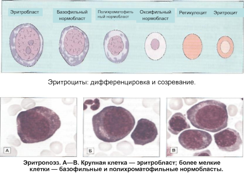 Эритроциты: дифференцировка и созревание.Эритропоэз. А—В. Крупная клетка — эритробласт; более мелкие клетки — базофильные и полихроматофильные нормобласты.Эритробласт