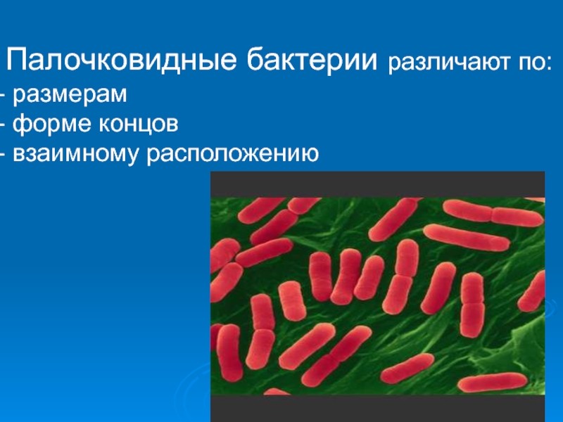 Палочковидные бактерии. Морфология микроорганизмов палочковидные. Палочковидные бактерии по форме. Палочковидные формы бактерий. Палочковидные микробы.