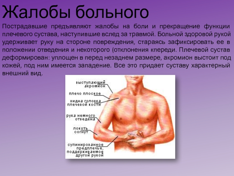 Статус локалис суставов. Вывих плечевого сустава локальный статус. Симптомы при вывихе плечевого сустава. Жалобы при вывихе плечевого сустава.