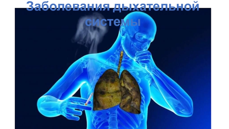 Презентация Заболевания дыхательной системы 8 класс