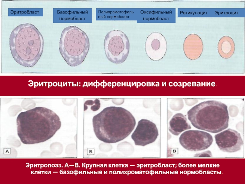 Нормобласты. Оксифильный нормобласт. Проэритробласт (эритробласт). Полихроматофильный эритробласт. Оксифильный полихроматофильный нормобласт.