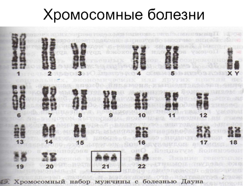 Хромосомные болезни примеры. Хромосомные болезни нарушение аутосом таблица. Хромосомные заболевания человека. Болезни с хромосомными нарушениями. Патологии хромосом у человека.