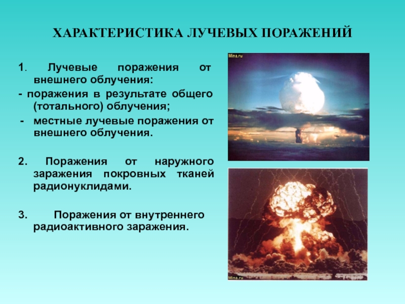 Лучевые поражения в результате внешнего общего облучения презентация