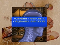 Основные  синдромы 