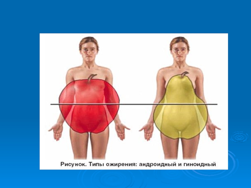 Типы ожирения фото