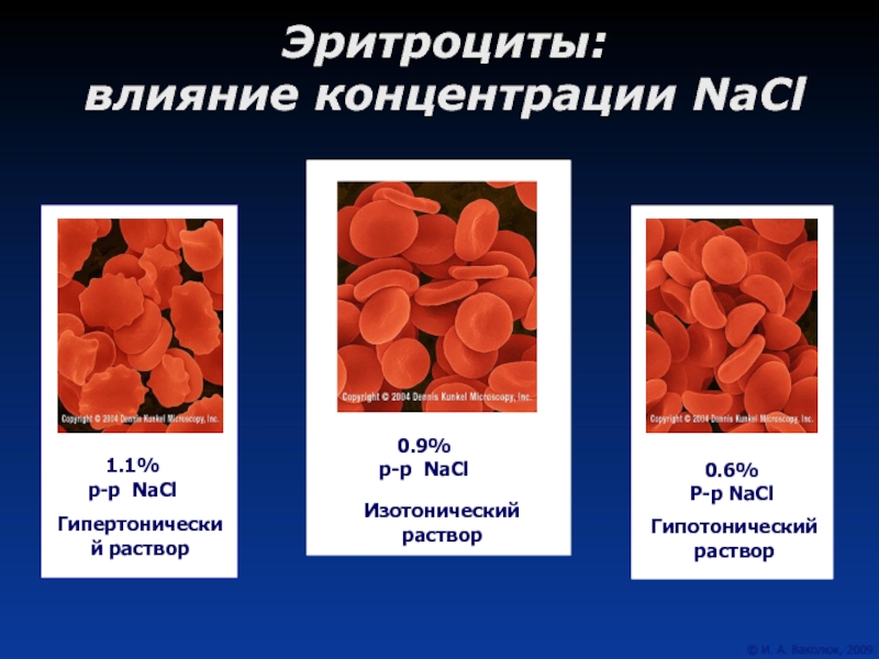 Посмотрите на изображение эритроцитов в разной среде в каком растворе находятся эритроциты на первом