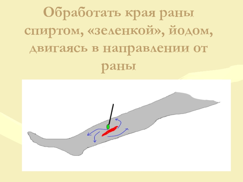 Как открыть рану. Чем обработать края раны.