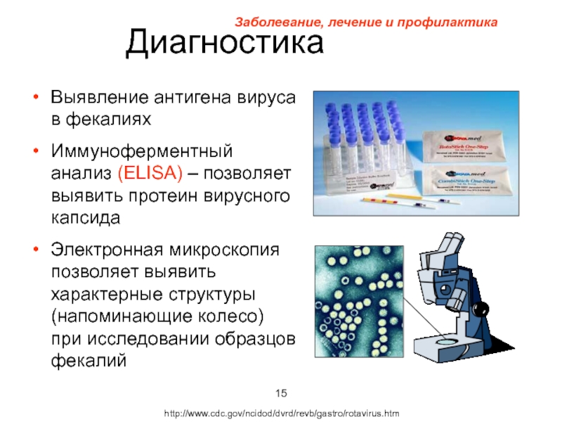 Выявление диагностика. ИФА вирусов. Обнаружение вирусных антигенов. Электронная микроскопия в диагностике вирусных болезней животных. Определение вируса ИФА.