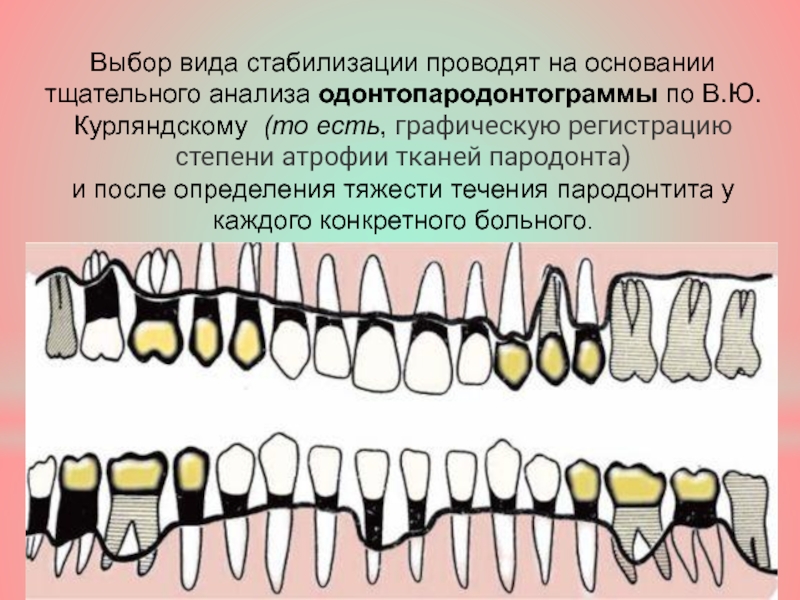 Карта исследования пародонта