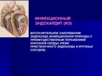ЗАБОЛЕВАНИЕ ЭНДОКАРДА