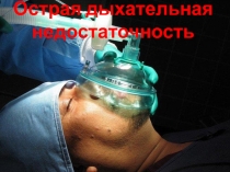 Острая дыхательная недостаточность