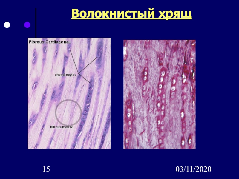 Волокнистый хрящ рисунок с подписями