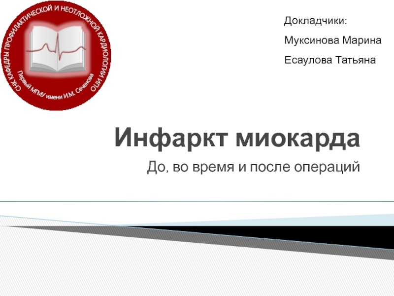 Инфаркт миокарда