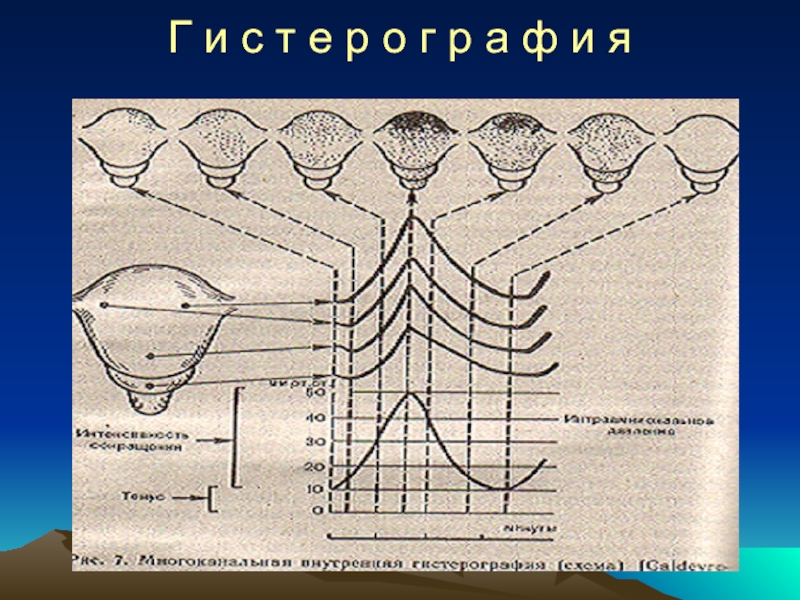 Аномалии сократительной деятельности матки. Сократительная деятельность матки. Регуляция сократительной деятельности матки. Сократительный белок матки.