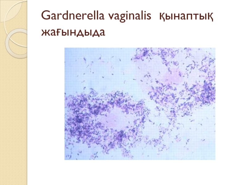 Днк gardnerella vaginalis что это