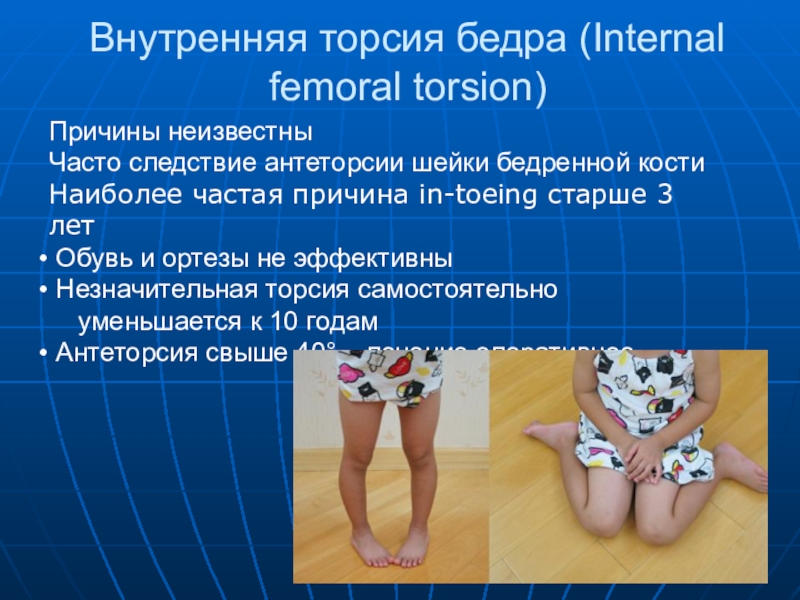 Внутренняя торсия бедра (Internal femoral torsion)Причины неизвестныЧасто следствие антеторсии шейки бедренной костиНаиболее частая причина in-toeing старше 3