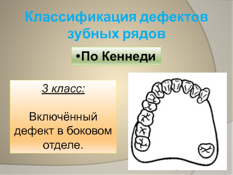 Дефекты зубных рядов