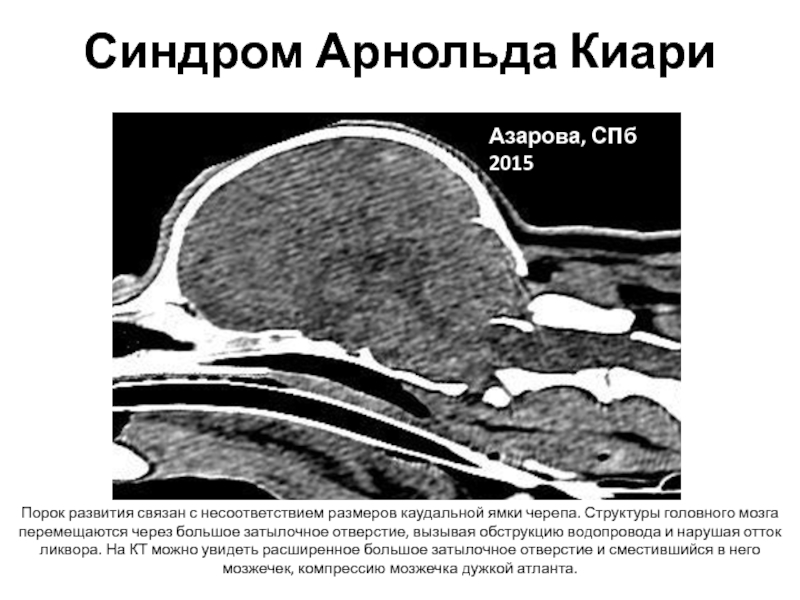 Кт в неврологии презентация