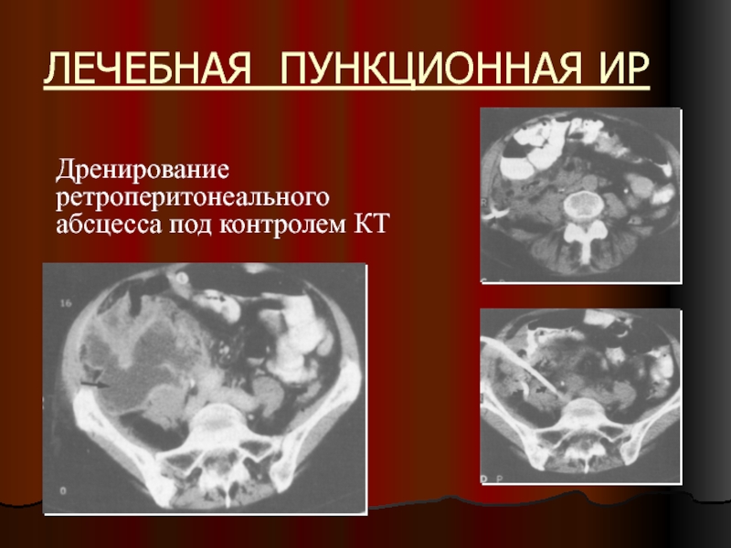 Женская радиология презентация