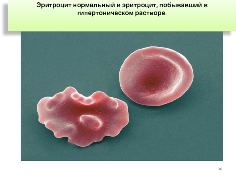 Посмотрите на изображение эритроцитов в разной среде в каком растворе находятся эритроциты на третье