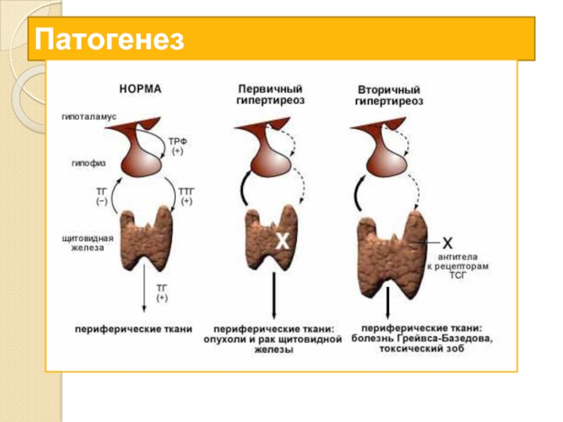 Патогенез гипотиреоза схема