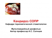 Кандидозы слизистой оболочки полости рта